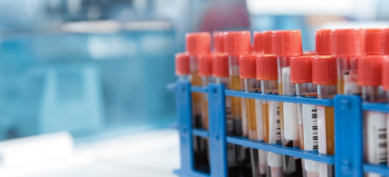 Amsterdam UMC, Locatie VUmc - Oncologieverpleegkundige