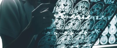MRI foto bekijken